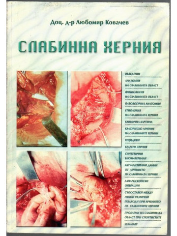 Слабинна херния Слабинна херния